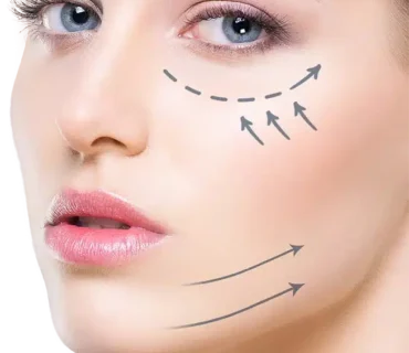 chirurgie visage